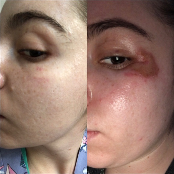 Roses water 🌹 tonic - Picture 5 of 6